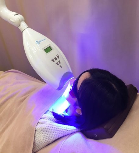ホワイトニング中