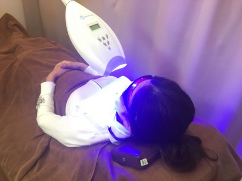 ホワイトニング中
